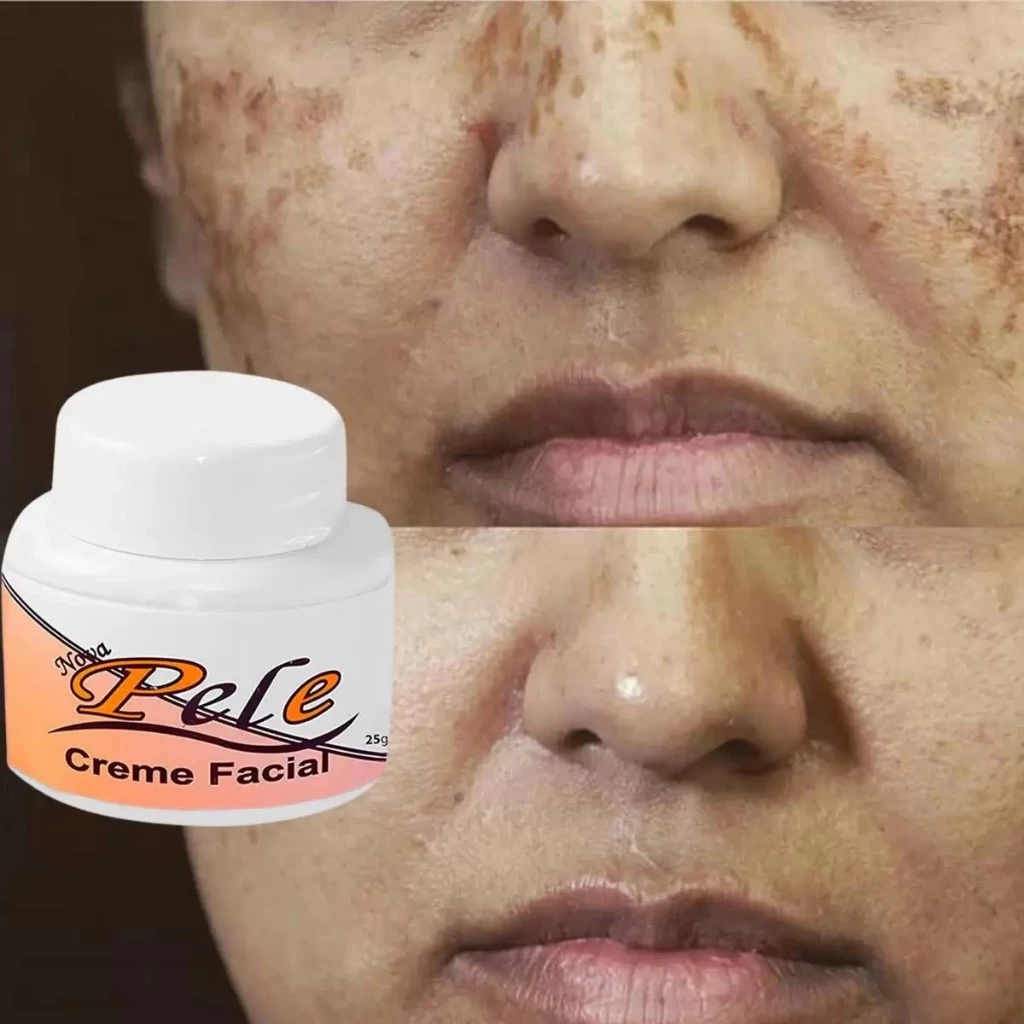 Capa do review: Como Clarear o Rosto: 5 Dicas Infalíveis + Melhores Cremes de 2026